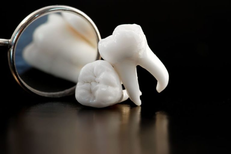 Myths And Misconceptions Surrounding Tooth Loss 